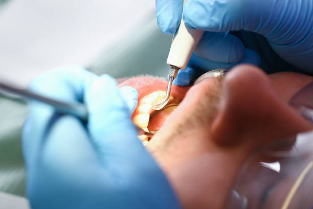 Best Urgent Dental Care for Toothache in Hamlin, TX