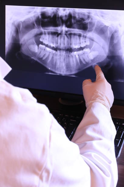 Best Emergency Dentist for Lost Fillings or Crowns in Hamlin, TX
